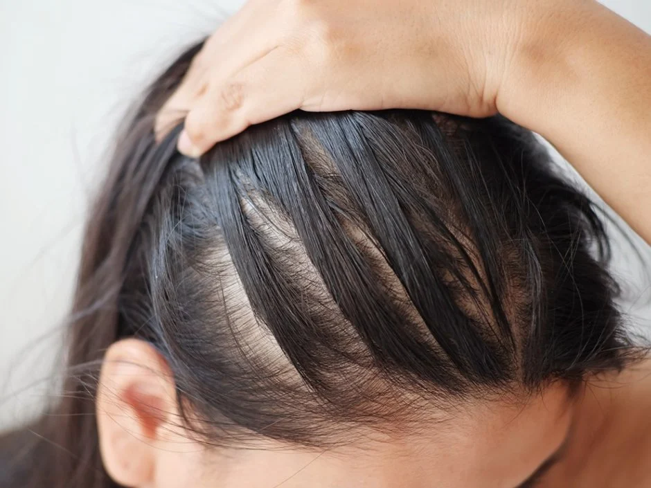 Mulher mostrando raiz do cabelo oleoso.